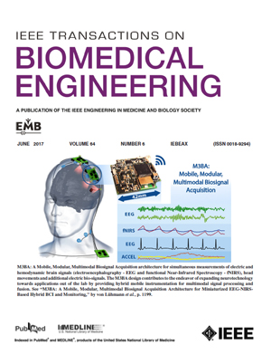 Deterioration of R-wave detection in pathology and noise