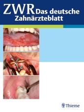 Platformswitching - Methodik zum Erhalt des periimplantären crestalen Knochens: Mythos oder Realität