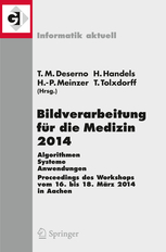 Nicht-lineare Zeitnormierung im Langzeit-EKG
