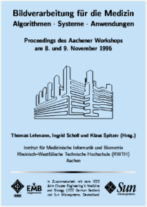 Trennung von diffuser und spiegelnder Reflexion in Farbbildern des Larynx zur Untersuchung von Farb- und Formmerkmalen der Stimmlippen