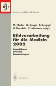 Lokalisation und Delineation des Kollimatorfeldes in digitalen und Film-basierten Röntgenbildern