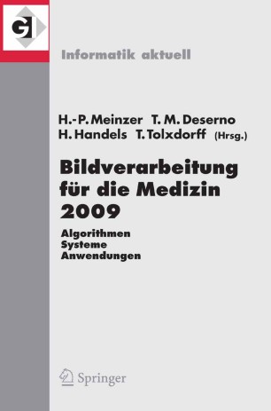 Evolutionäres Graphmatching zur Handknochen-Identifikation