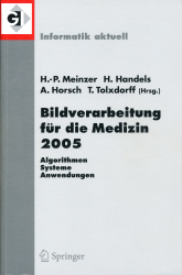 Effektive Implementierung von Algorithmen zum inhaltsbasierten Bildzugriff auf medizinischen Bilddaten