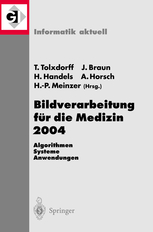 Ein lokal-adaptives Ähnlichkeitsmaß als Kriterium der hierarchischen Regionenverschmelzung